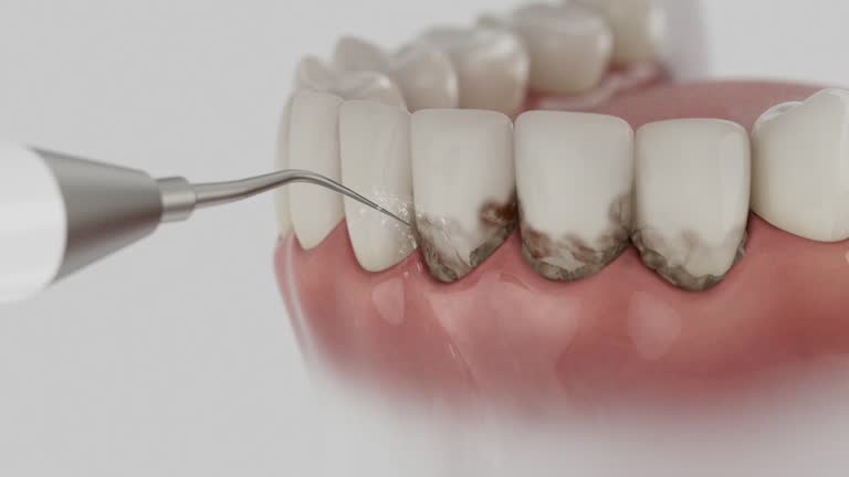 Trusted Tooth Extraction service in Allendale, MI - Dentist Open Now